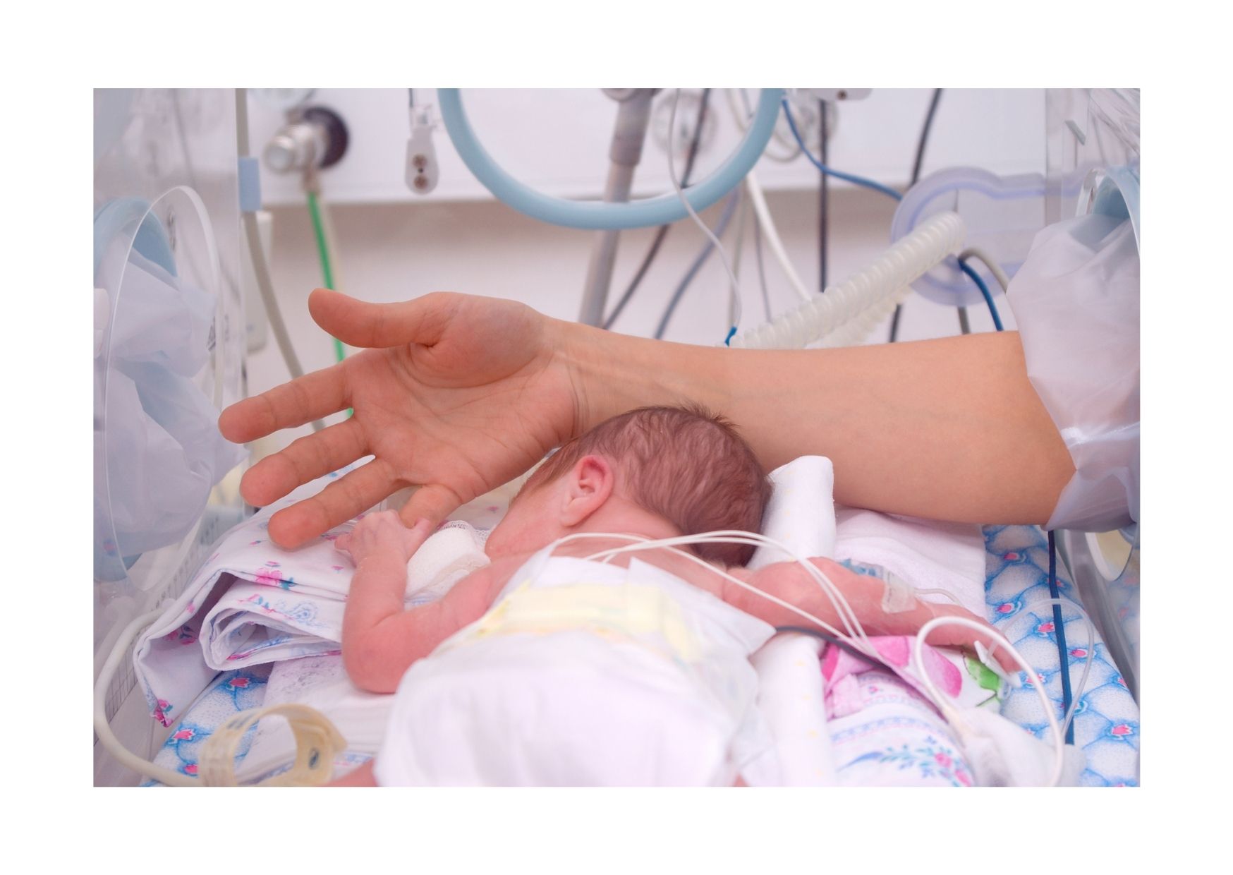 neonato prematuro e osteopatia